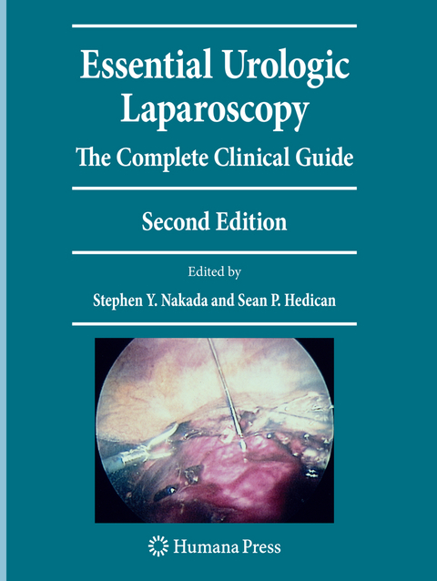 Essential Urologic Laparoscopy - 