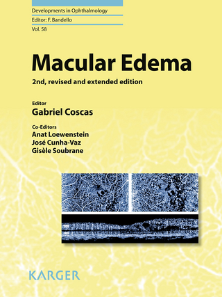 Macular Edema - G. Coscas; A. Loewenstein; J. Cunha-Vaz; G. Soubrane