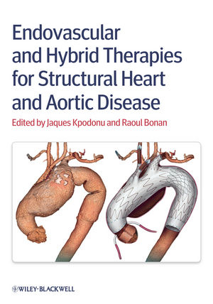 Endovascular and Hybrid Therapies for Structural Heart and Aortic Disease - 