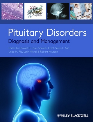 Pituitary Disorders - Edward R. Laws; Shereen Ezzat; Sylvia L. Asa; Linda M. Rio; Lorin Michel