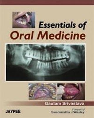 Essentials of Oral Medicine - Gautam Srivastava