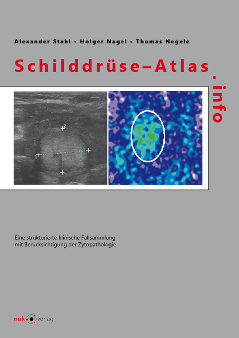 Schilddrüse-Atlas.info - Alexander Prof. Dr. med. Stahl
