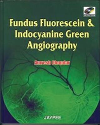 Fundus Fluorescien and Indocyanine Green Angiography - A Chopdar