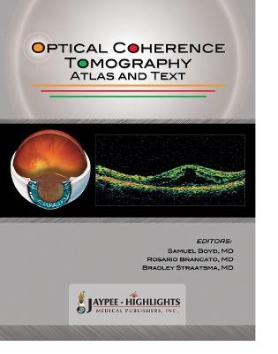 Optical Coherence Tomography - Samuel Boyd; Rosario Brancato; Bradley Straatsma
