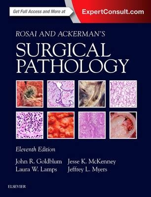 Rosai and Ackerman's Surgical Pathology - 2 Volume Set - John R. Goldblum, Laura W. Lamps, Jesse K. McKenney, Jeffrey L. Myers