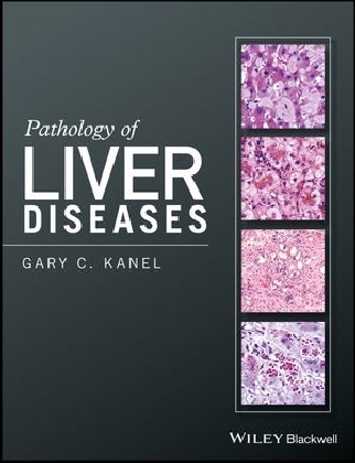 Pathology of Liver Diseases - Gary C. Kanel