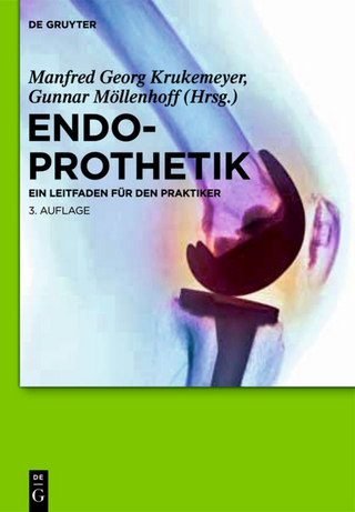 Endoprothetik - Manfred Georg Krukemeyer; Gunnar Möllenhoff