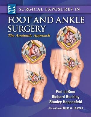 Surgical Exposures in Foot & Ankle Surgery - Piet deBoer, Richard Buckley, Stanley Hoppenfeld