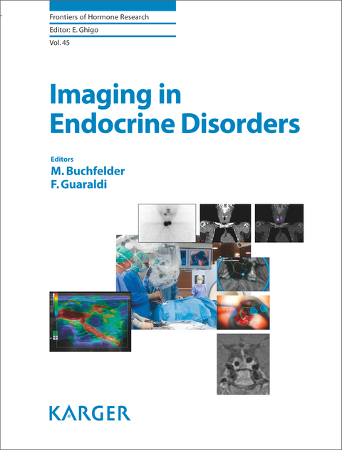 Imaging in Endocrine Disorders - 