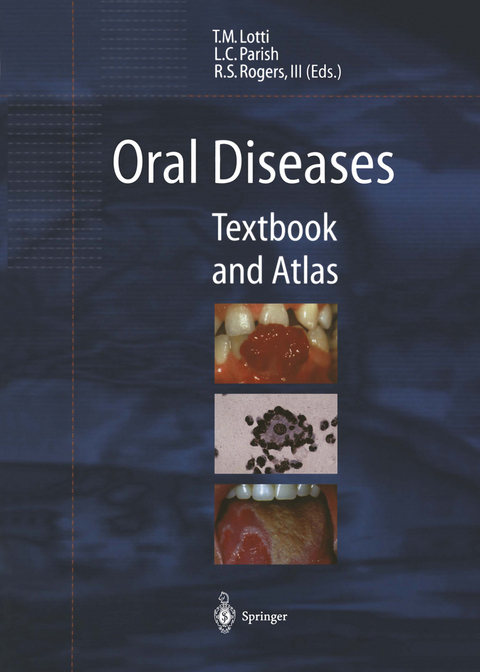 Oral Diseases - 