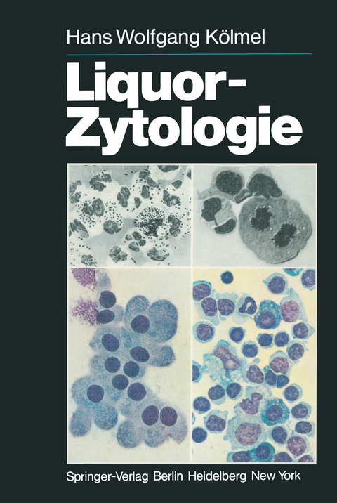 Liquor-Zytologie - H.W. Kölmel