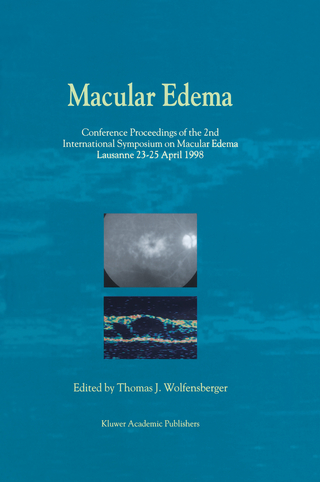 Macular Edema - Thomas J. Wolfensberger