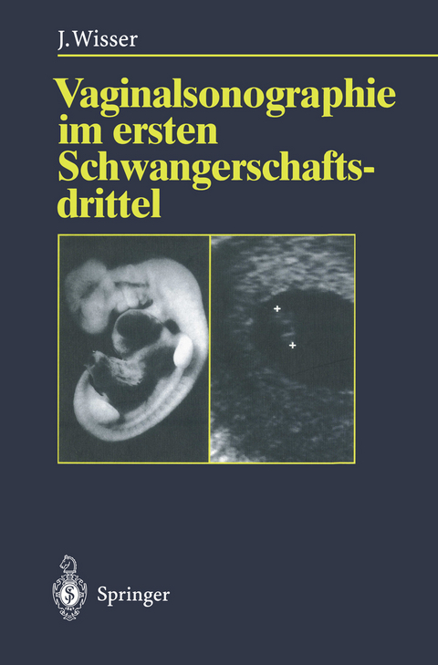 Vaginalsonographie im ersten Schwangerschaftsdrittel - Josef Wisser