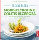 Gesund essen - Morbus Crohn & Colitis ulcerosa - Gudrun Biller-Nagel;  Christiane Schäfer