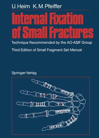 Internal Fixation of Small Fractures - Urs Heim; Karl M. Pfeiffer