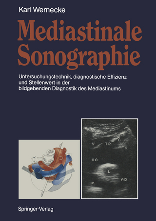 Mediastinale Sonographie - Karl Wernecke