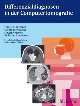 Differenzialdiagnosen in der Computertomografie - Francis A. Burgener, Christopher Herzog, Steven Meyers, Wolfgang Zaunbauer