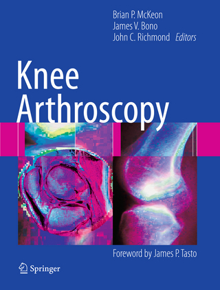 Knee Arthroscopy - Brian McKeon; James V. Bono; John C. Richmond