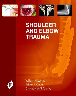 Shoulder and Elbow Trauma - William N. Levine