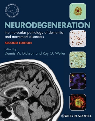 Neurodegeneration - Dennis Dickson; Roy O. Weller