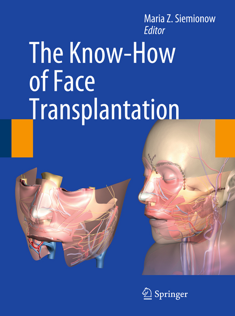 The Know-How of Face Transplantation - 