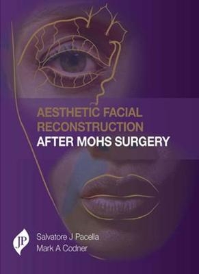 Aesthetic Facial Reconstruction After Mohs Surgery - Salvatore Pacella, Mark A Codner