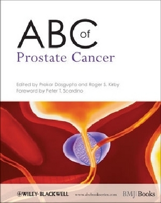 ABC of Prostate Cancer - P DasGupta