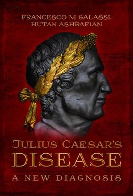 Julius Caesar's Disease - Hutan Ashrafian; Francesco Maria Galassi
