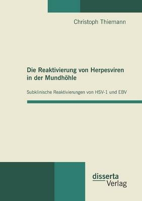Die Reaktivierung von Herpesviren in der Mundhöhle: Subklinische Reaktivierungen von HSV-1 und EBV - Christoph Thiemann