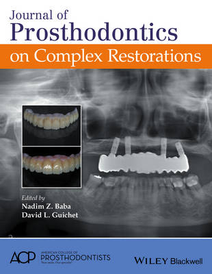 Journal of Prosthodontics on Complex Restorations - 