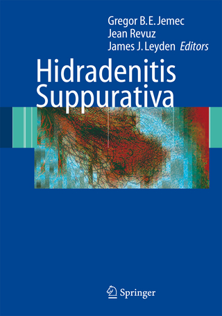 Hidradenitis Suppurativa - Gregor Jemec; Jean Revuz; James J. Leyden