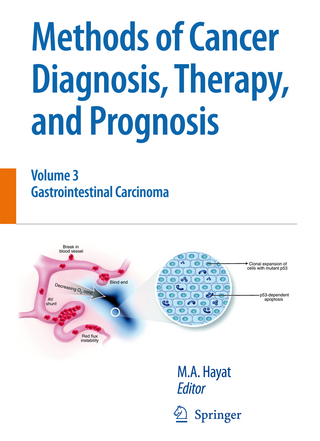 Methods of Cancer Diagnosis, Therapy and Prognosis - M. A. Hayat