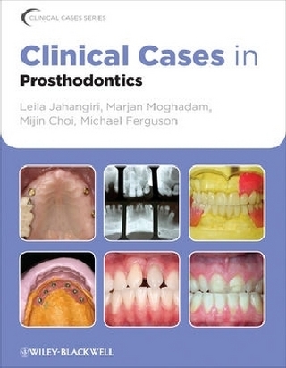 Clinical Cases in Prosthodontics - Leila Jahangiri; Marjan Moghadam; Mijin Choi; Michael Ferguson