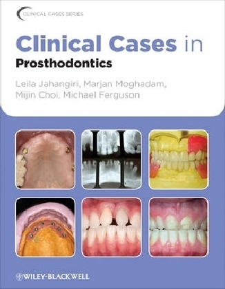 Clinical Cases in Prosthodontics - Leila Jahangiri, Marjan Moghadam, Mijin Choi, Michael Ferguson