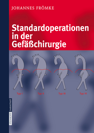 Standardoperationen in der Gefäßchirurgie - Johannes Frömke
