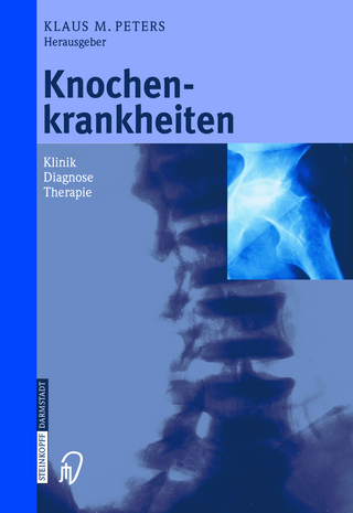Knochenkrankheiten - Klaus M. Peters
