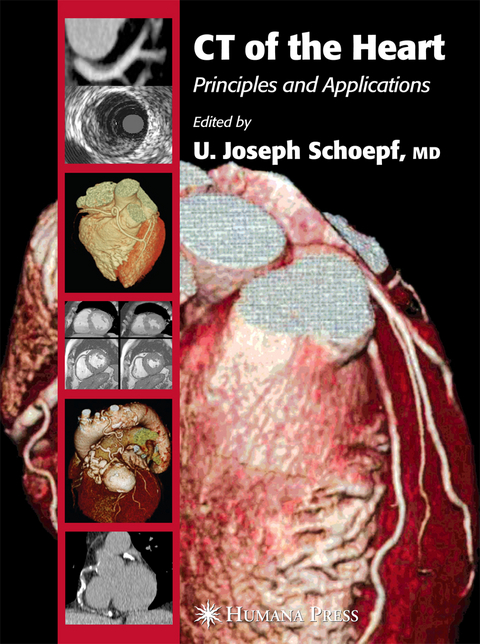 CT of the Heart - 