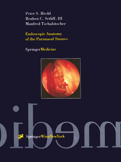 Endoscopic Anatomy of the Paranasal Sinuses - Peter S. Hechl, Reuben C. Setliff  III, Manfred Tschabitscher