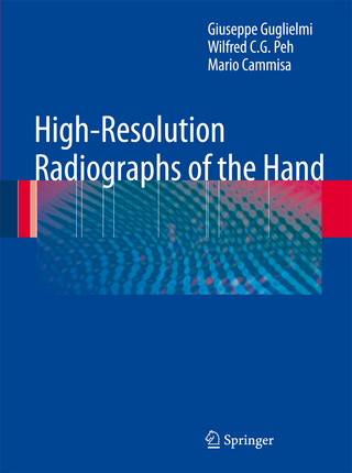 High-Resolution Radiographs of the Hand - Giuseppe Guglielmi; Wilfred C. G. Peh; Mario Cammisa