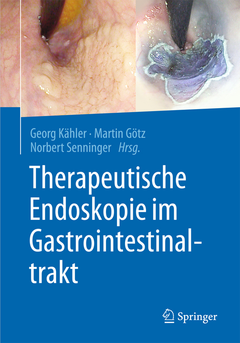 Therapeutische Endoskopie im Gastrointestinaltrakt - 
