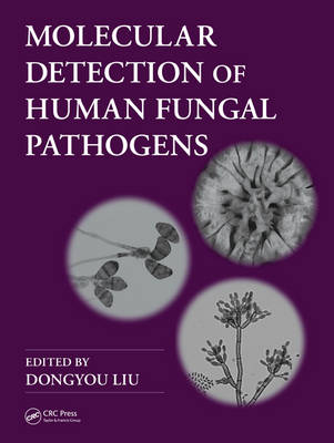 Molecular Detection of Human Fungal Pathogens - Dongyou Liu