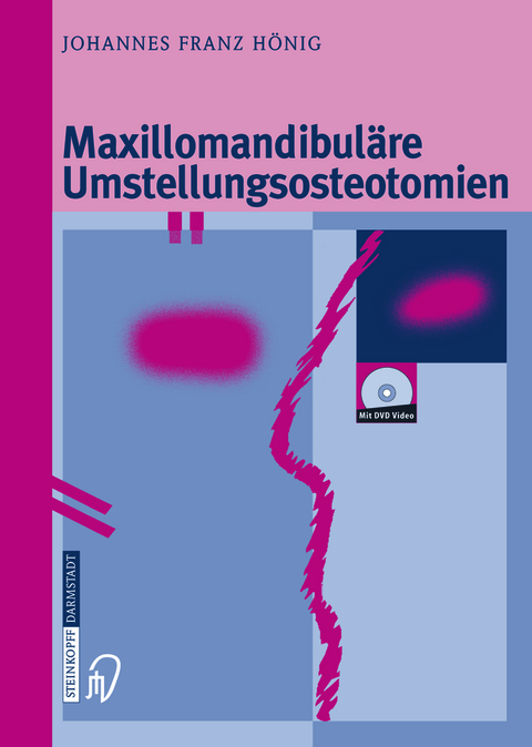 Maxillomandibuläre Umstellungsosteotomien - Johannes-Franz Hönig