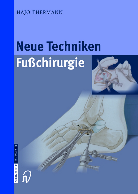 Neue Techniken Fusschirurgie - Hajo Thermann