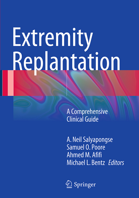 Extremity Replantation - 