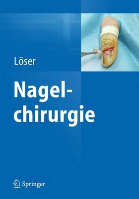 Nagelchirurgie - Christoph Löser