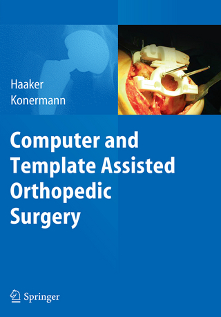 Computer and Template Assisted Orthopedic Surgery - Rolf Haaker; Werner Konermann