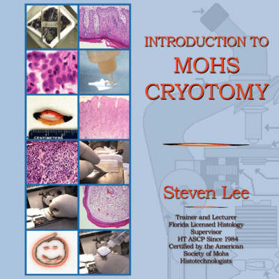 Introduction to MOHS Cryotomy - Dr Steven Lee