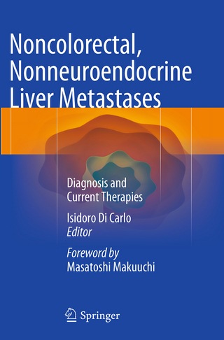 Noncolorectal, Nonneuroendocrine Liver Metastases - Isidoro Di Carlo