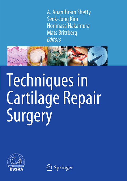 Techniques in Cartilage Repair Surgery - 