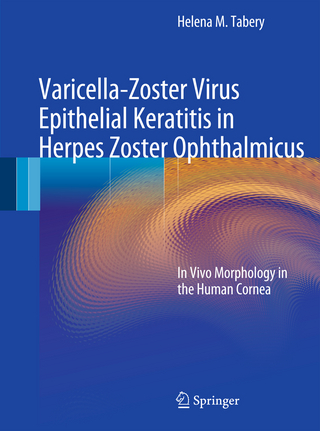 Varicella-Zoster Virus Epithelial Keratitis in Herpes Zoster Ophthalmicus - Helena M. Tabery